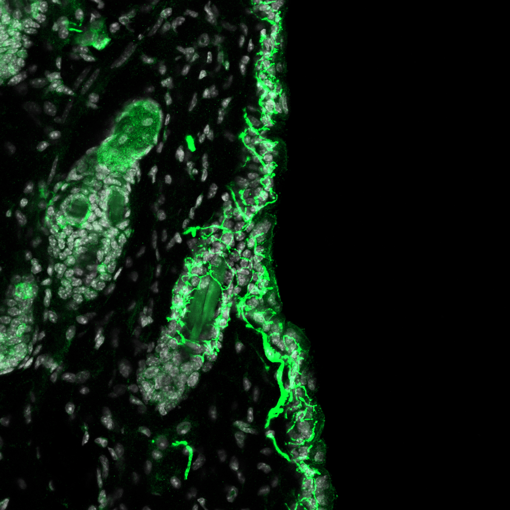 Mrgprb4-lineage nerve terminal endings in the hairy skin of the mouse back, labeled via immunofluorescence.