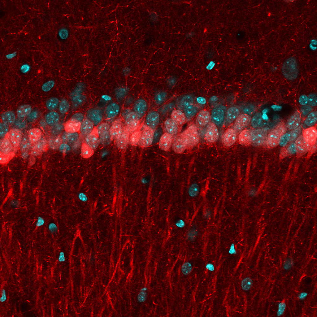 Microscopic image of cells in the CA1 region of the hippocampus, divided into two sublayers, with the superficial layer in red and deep layer in cyan