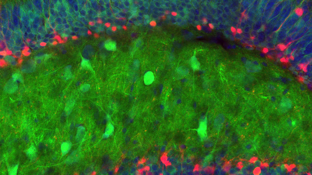 Granule cells of the mouse dentate gyrus, with newborn flourescently labelled red