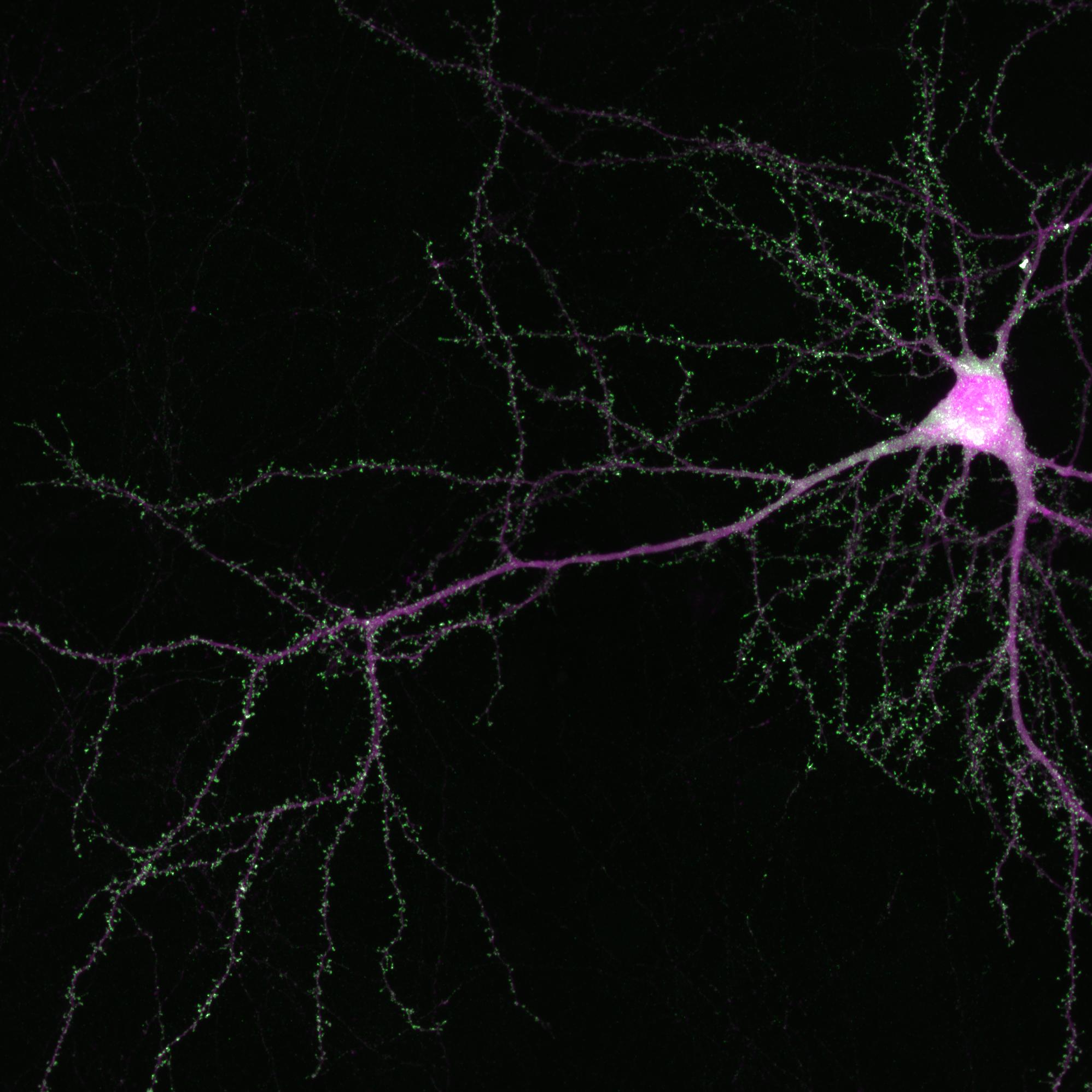 Single neuron in the mouse cortex showing SRGAP2 with flourescent marker