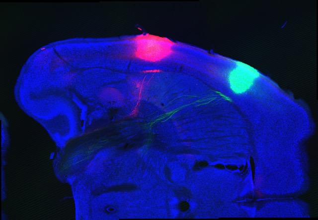 Mouse brain in blue with location of the bitter cortex in red and sweet cortex in green