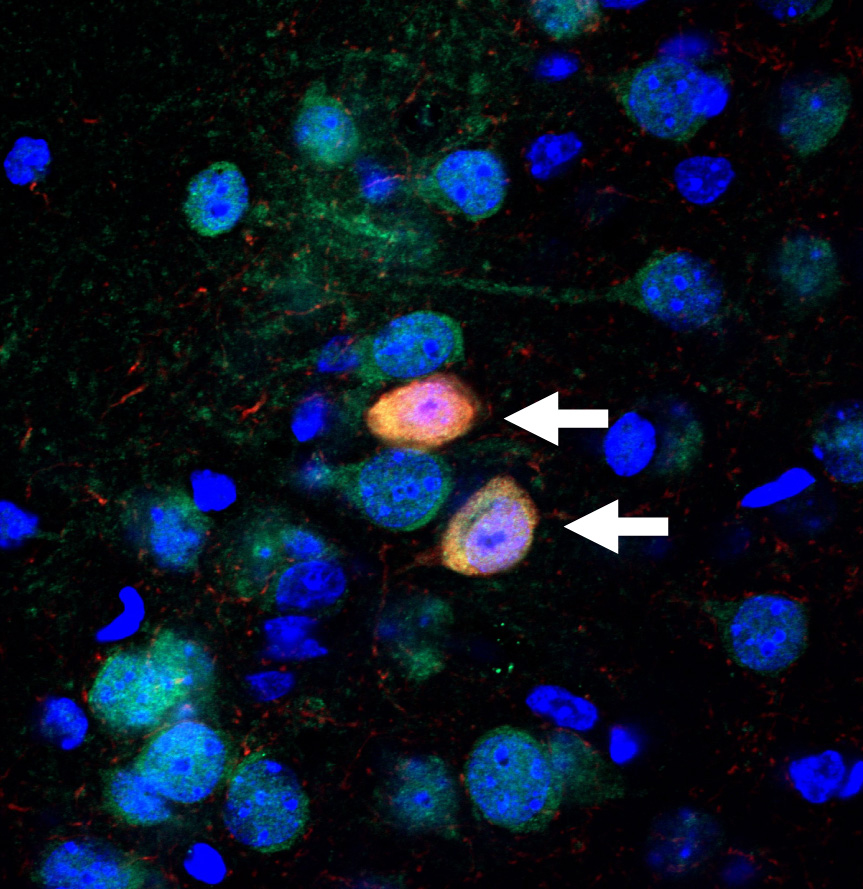 flourescent image of GABA-producing neurons in the brain, with arrows pointing to ones that contain the enzyme PRODH, often defective in Schizophrenia