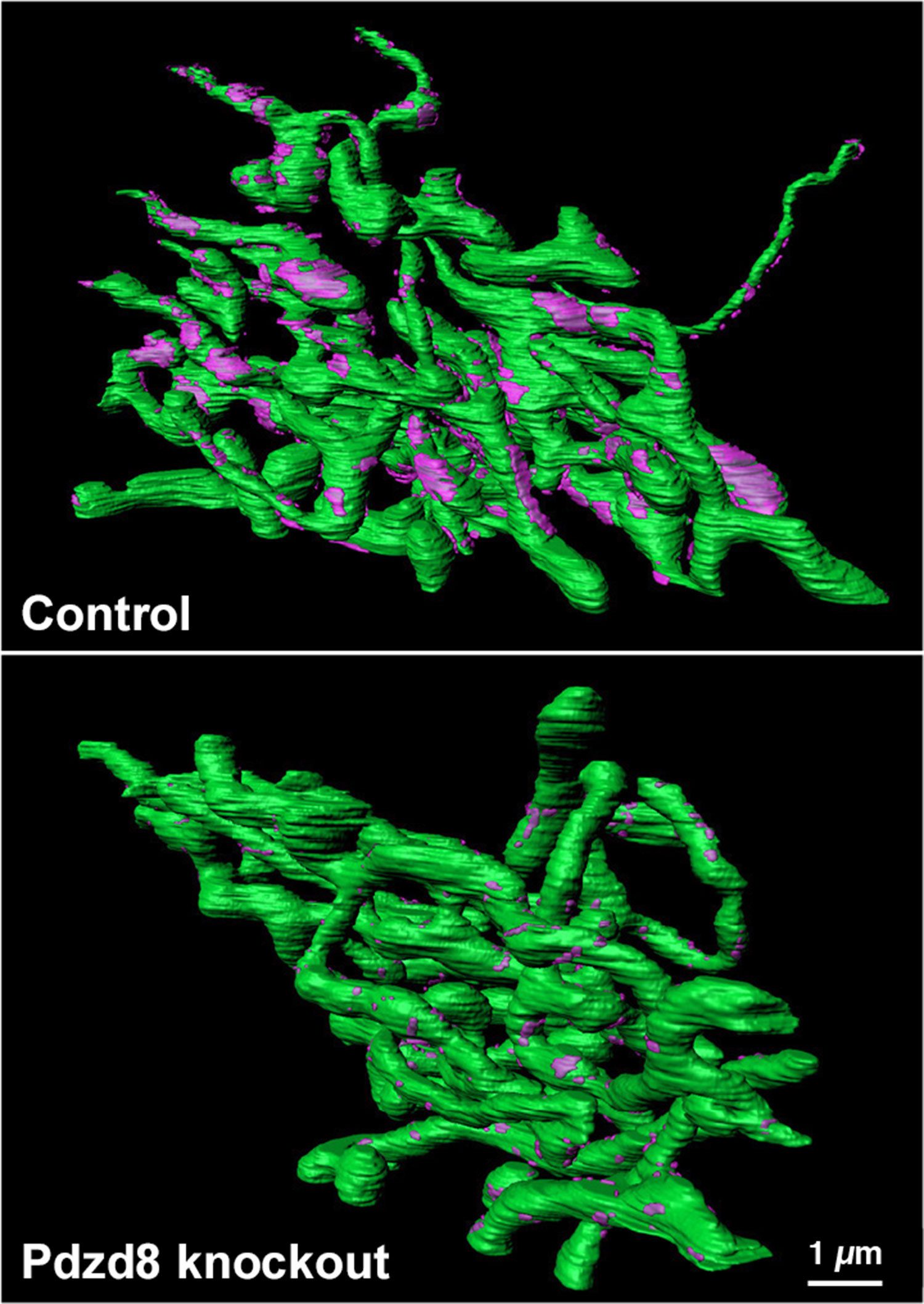 Reconstruction of mitochondrial-ER contact points in a control cell (top) compared to a cell lacking PDZD8 Credit: Yusuke Hirabayashi/Polleux Lab/Columbia's Zuckerman Institute)