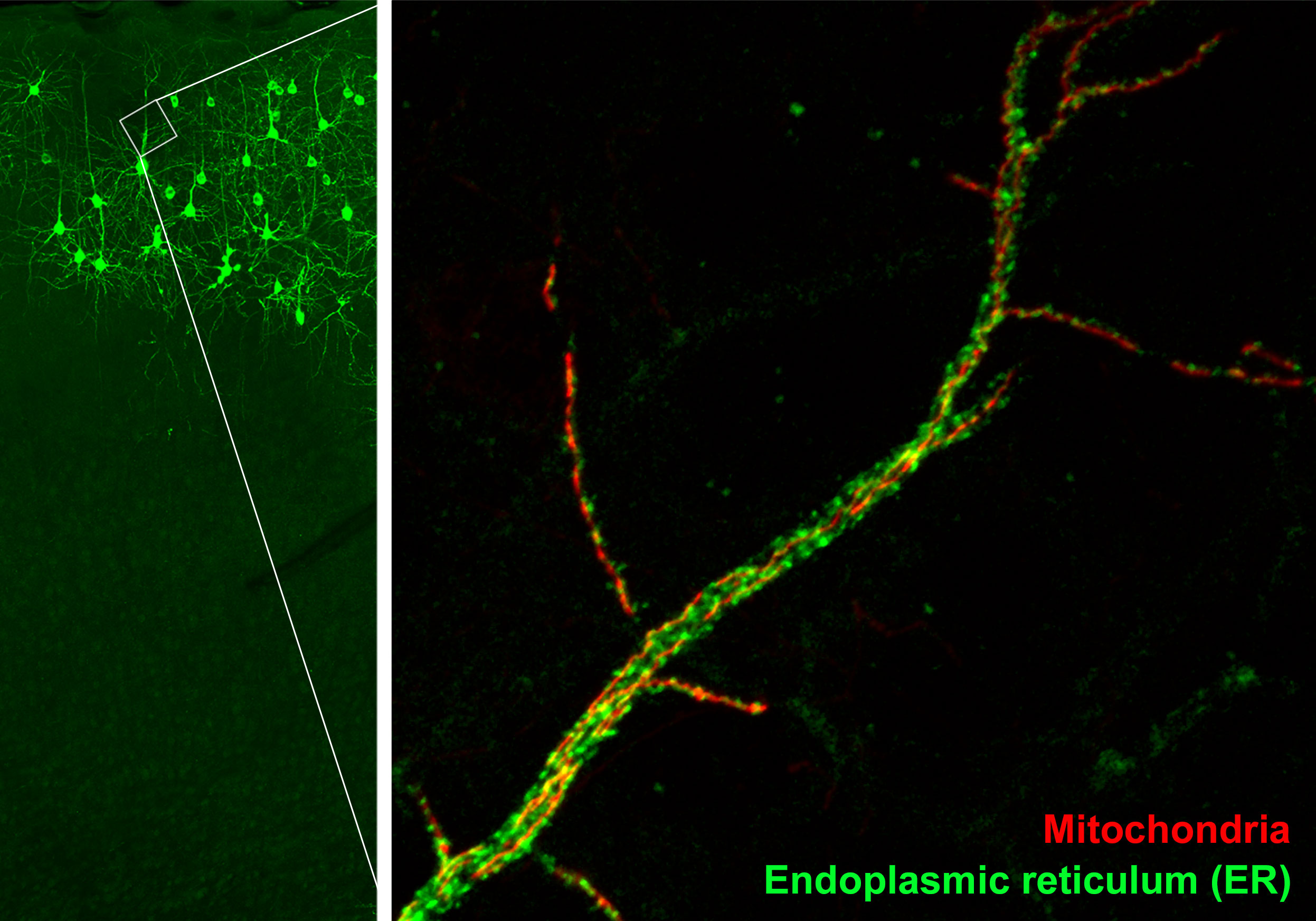Zoomed-in image of mitochondria (red) and endoplasmic reticulum (green) in the dendrite of a neuron (Credit: Yusuke Hirabayashi/Polleux Lab/Columbia's Zuckerman Institute).