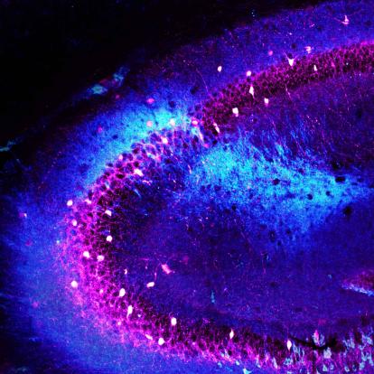 Mouse hippocampus with CA2 region stained light blue, used to study schizophrenia