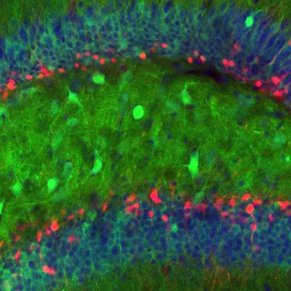 green flourescently labelled neurons in the mouse dentate gyrus
