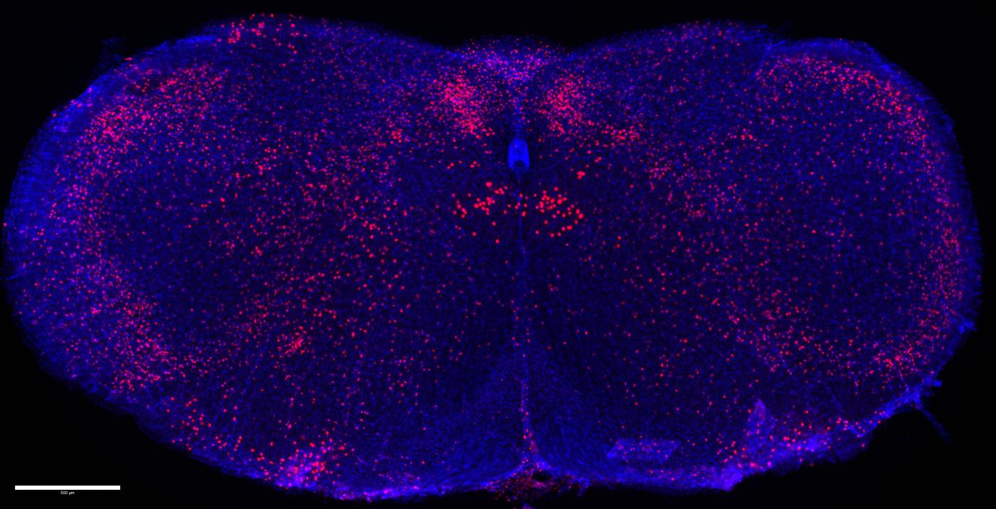 Sugar-sensing neurons (pink) in cNST brain region of a mouse (Credit: Hwei-Ee Tan/Zuker lab/Columbia's Zuckerman Institute).