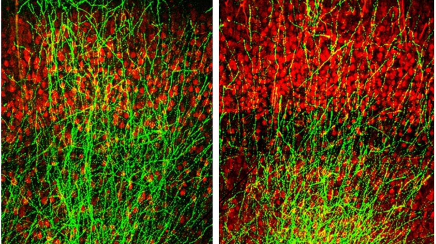 Scientists Eliminate Core Symptom of Schizophrenia in Mice