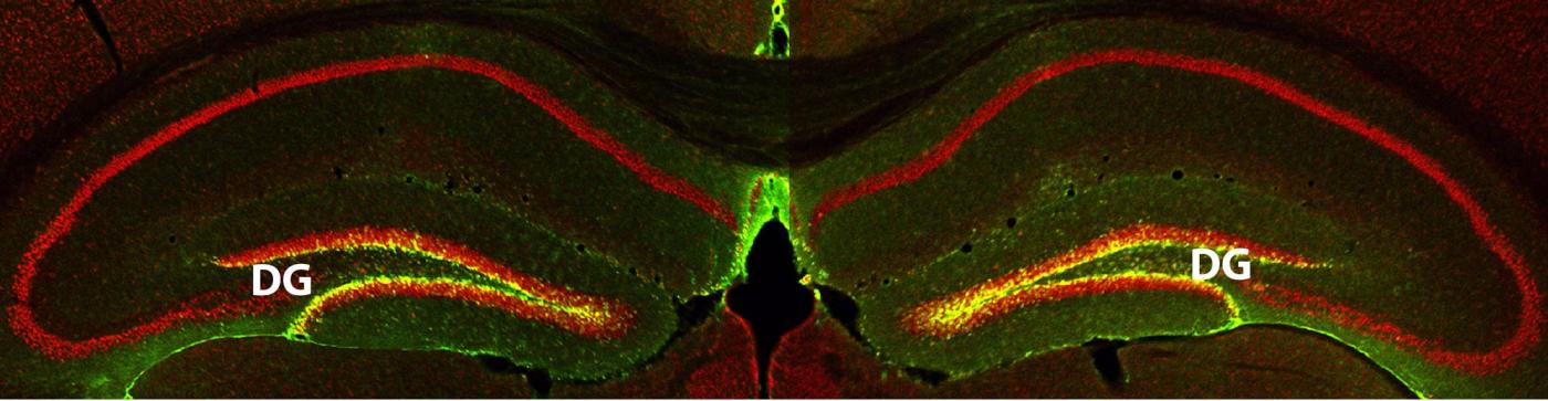 The researchers have identified a protein—RbAp48—that, when increased in aged wild-type mice, improves memory back to that of young wild-type mice. In the image, yellow shows the increased RbAp48 in the dentate gyrus. Image credit: Elias Pavlopoulos, PhD/Columbia University Medical Center