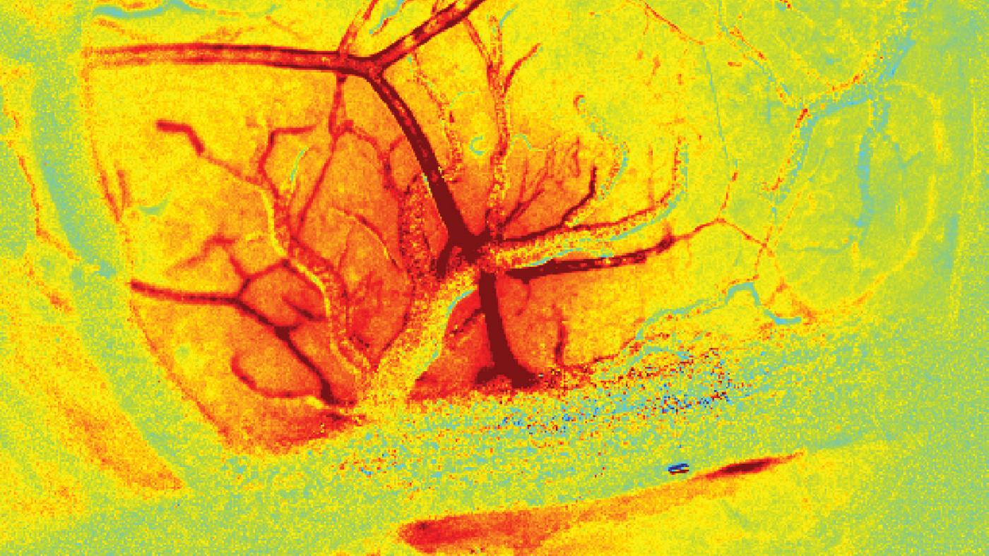 new imaging techniques reveal a rush of blood (red) to vessels in the brain