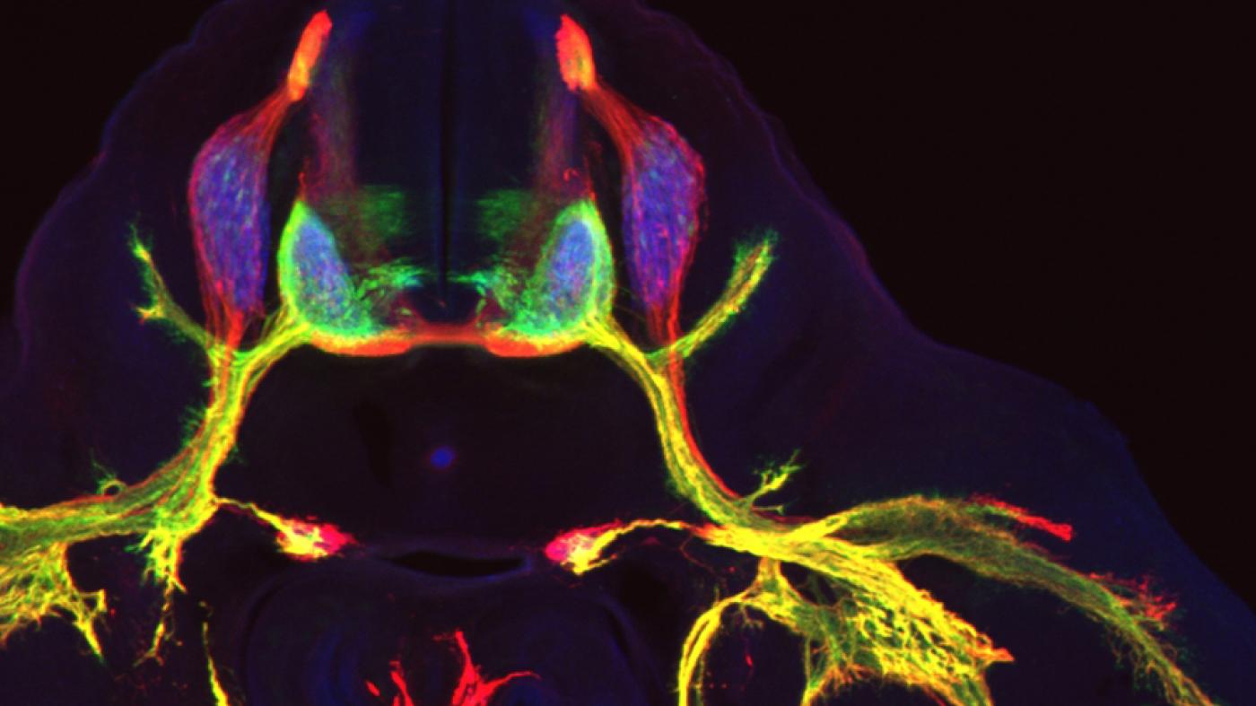 Flourescent image of motor neurons by the Jessell Lab
