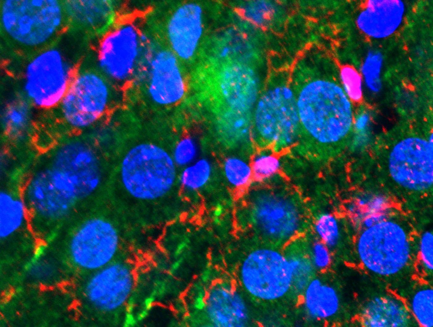 The hippocampus of a female mouse that has been genetically engineered to overproduce TIA1 protein. (The green color indicates neurons that produce excess TIA1, while the blue color lights up the nucleus of each cell to permit easier visualization of cells within the tissue). Increased levels of TIA1 protein lead to heightened activity of immune system cells such as microglia (shown in red). Immune system genes and cells not only regulate immune function, but also modulate brain function, including learning and memory (Credit: Joseph Rayman/Kandel lab/Columbia's Zuckerman Institute).
