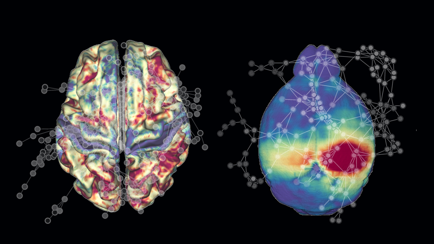 マウス研究からヒト脳の老化メカニズムを解明（To Understand How the Human Brain Ages, Science Reveals New Insights From Mice）