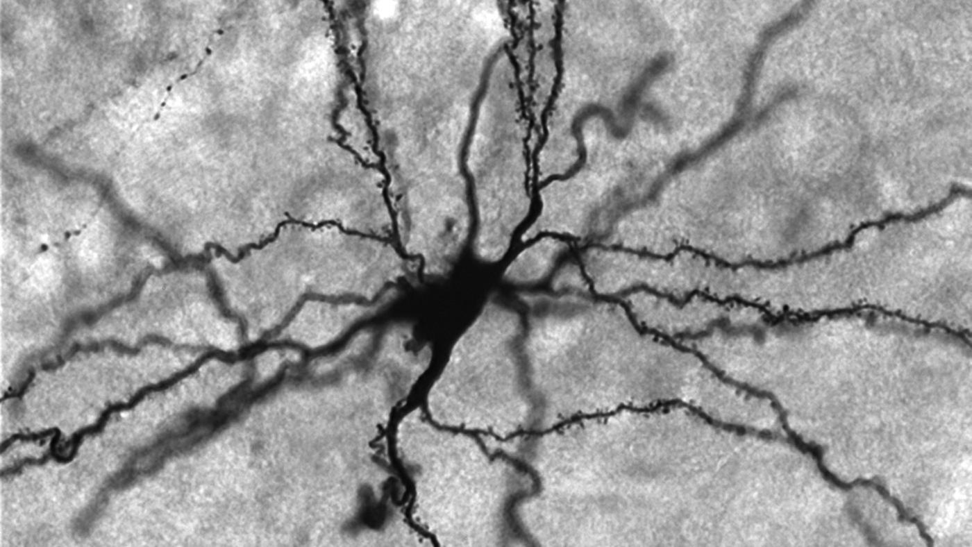 black and white image of neuron with numerous projections from the amygdala