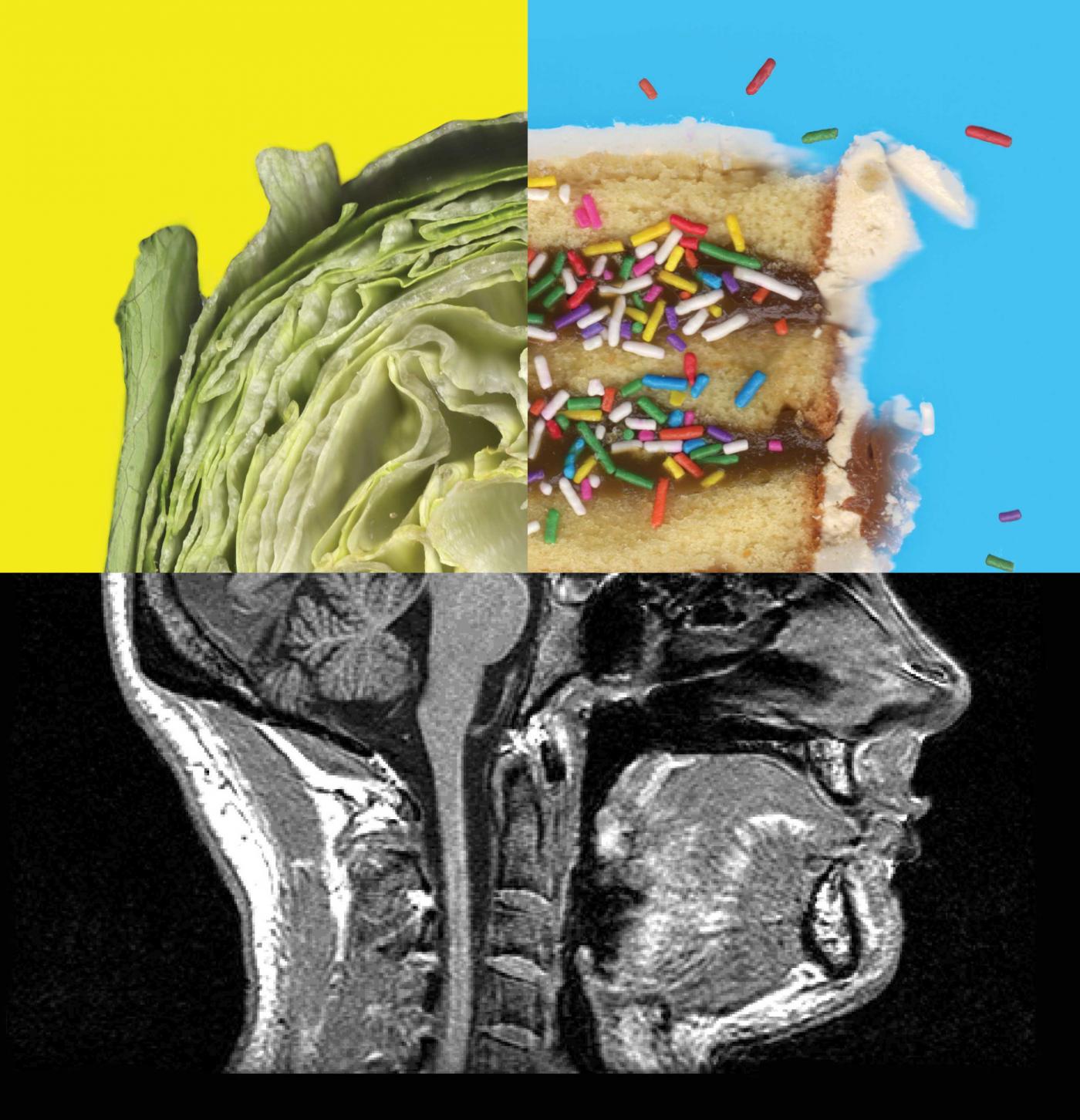 collage of human head made of lettuce, birthday cake with sprinkles, and xray of lower half of human head