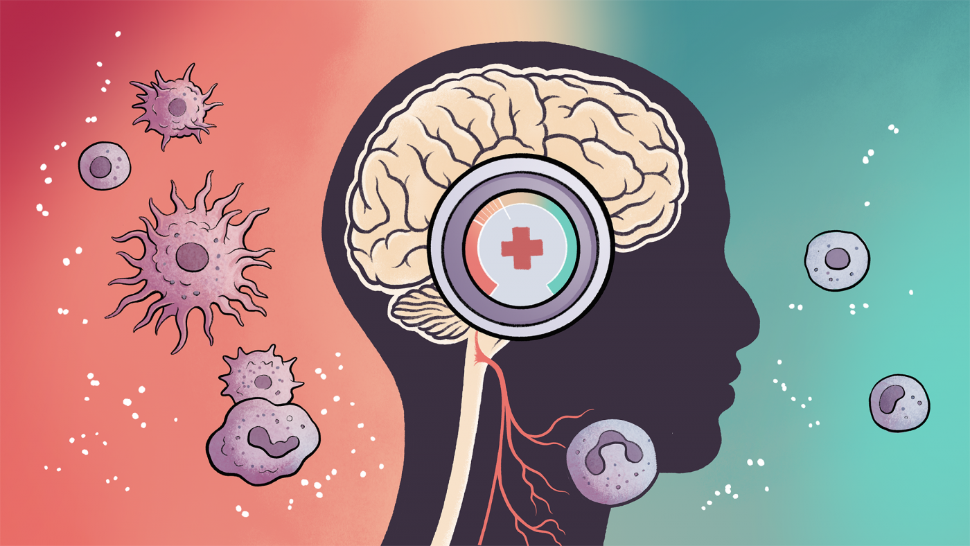 Illustration of a human brain with a thermostat-like device that symbolizes the brain's ability to amp up or tamp down inflammation responses, which are represented by a hot response with many immune-system cells and a cooler response with fewer cells.