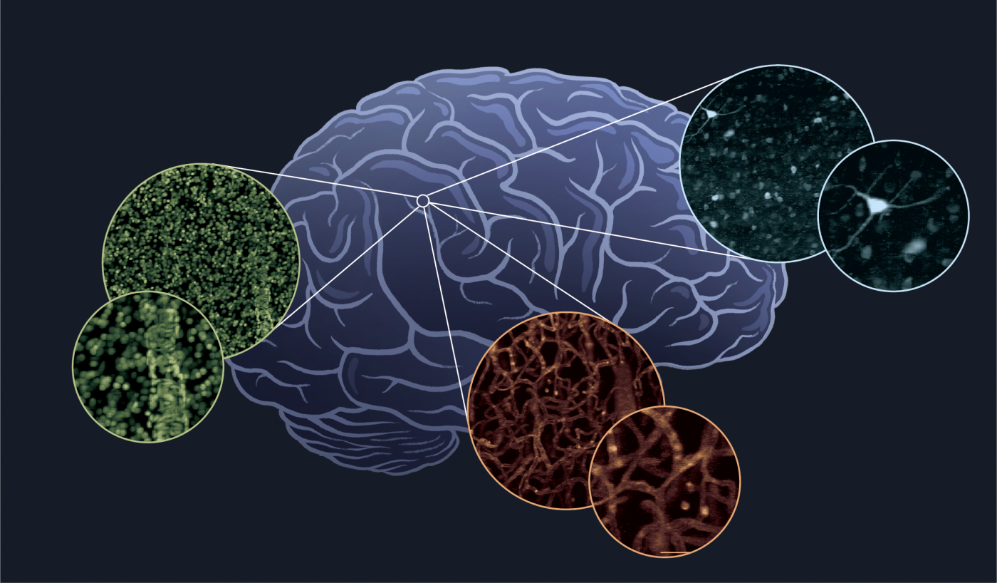 Researchers Undertake Challenge To Image Every Cell In The Human Brain ...