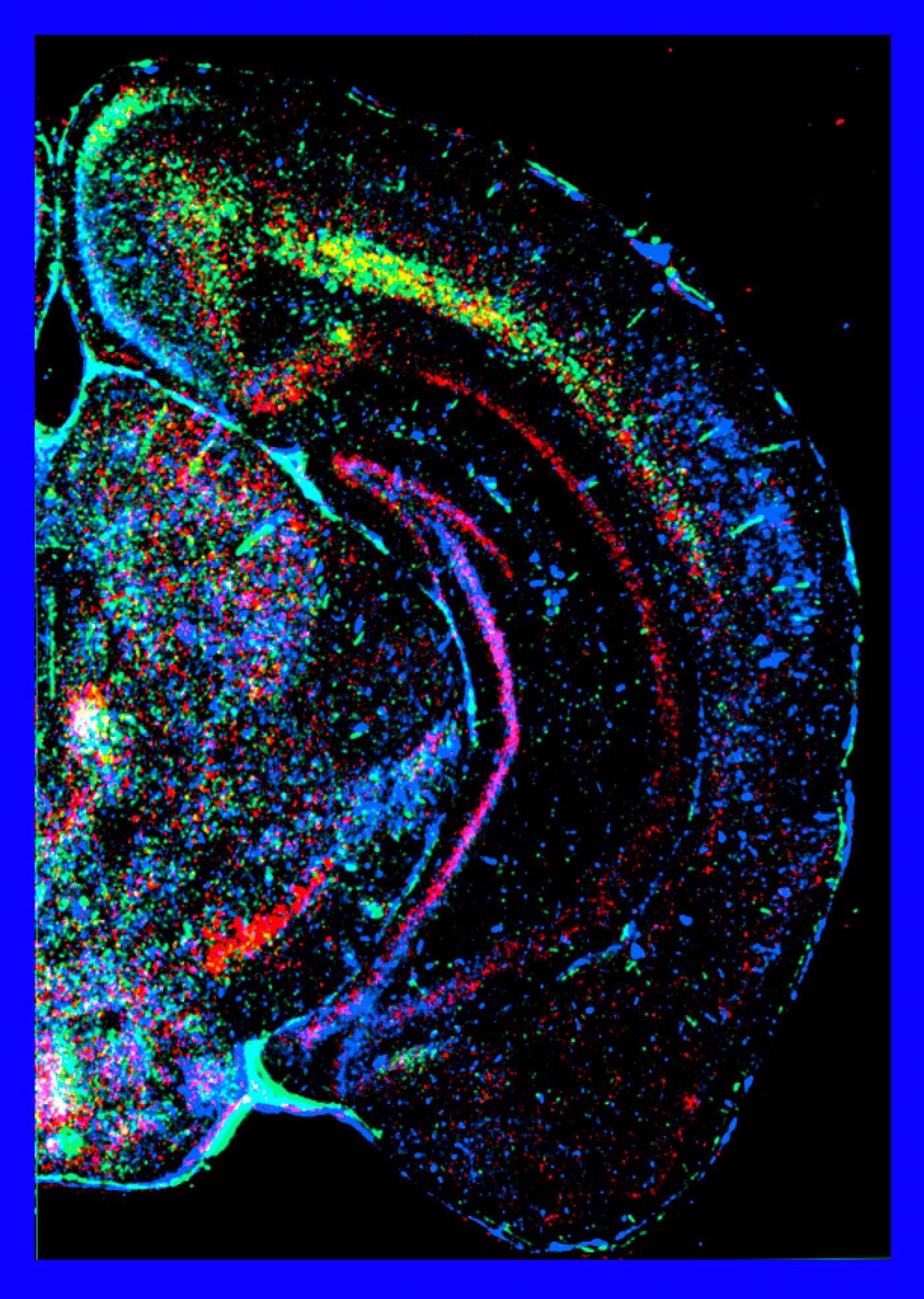 THE SPLATTERS 脳内出血 (413TRACKS/FTCS-2276) Saving the Synapse: Developmental Critical Periods and Alzheimer's