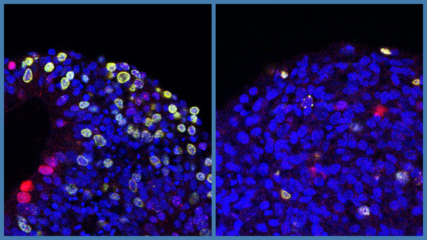 田仲真治「Brain Update」 Identity prediction errors in the human midbrain update