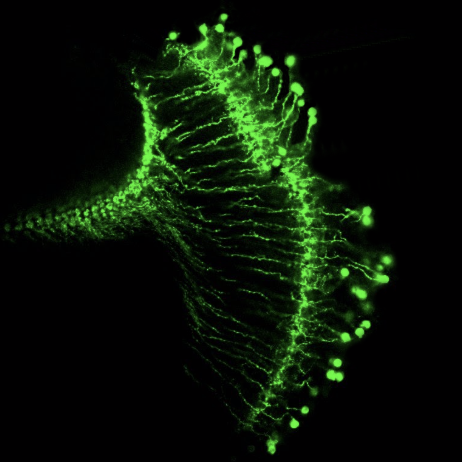 New Discovery About Fly Eyes Could Help Scientists Better Understand Human  Night Blindness