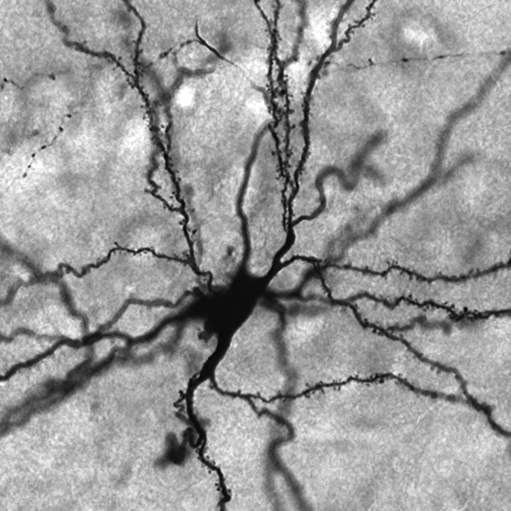 black and white image of neuron found in the amygdala with numerous projections